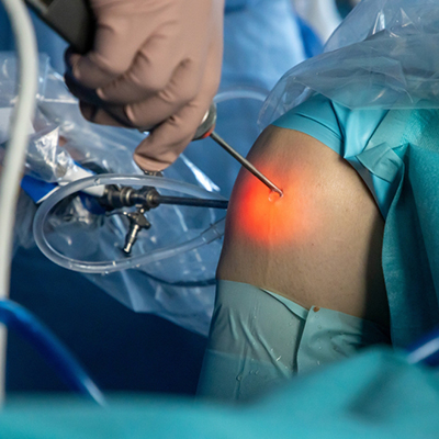 benefits-of-arthroscopy-minimally-invasive-joint-surgery