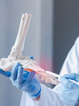 Osteoporosis, it is not just for women